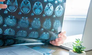 Un médecin examine un IRM cérébral, cherchant des indices sur l'oreille interne.