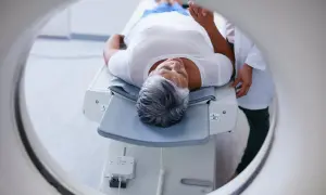 Une femme âgée se repose sur une table d'examen, prête pour un examen PET scan. C'est quoi un PET scan ? Une technique d'imagerie médicale.