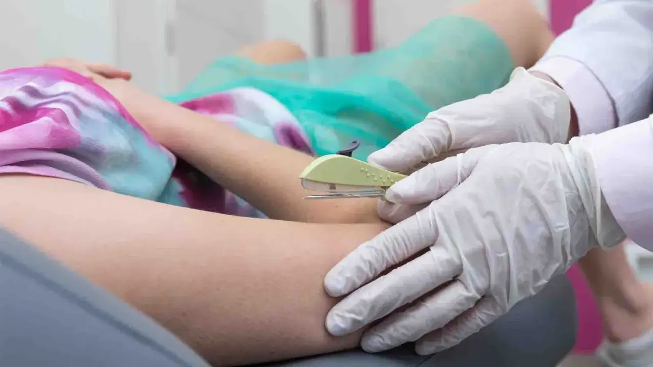 Pose d'un implant contraceptif sous la peau du bras par un professionnel de santé.