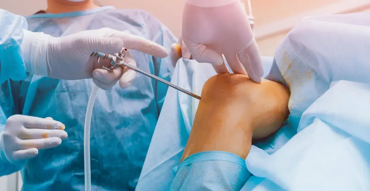 Un chirurgien orthopédiste utilise un arthroscope pour examiner le genou d'un patient lors d'une intervention chirurgicale.