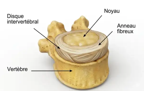 Disque intervertébral, noyau et anneau fibreux, montrant la structure d'une vertèbre, essentielle pour comprendre une hernie discale.