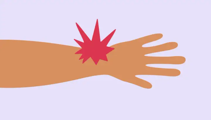 Douleur bras gauche - Cardiaque ou bénigne? Le guide pour savoir